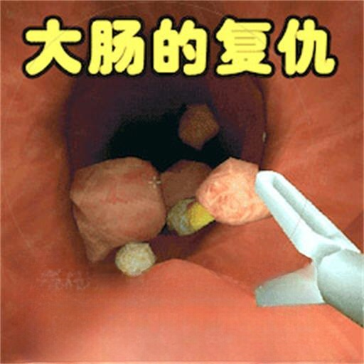 肠道检查游戏