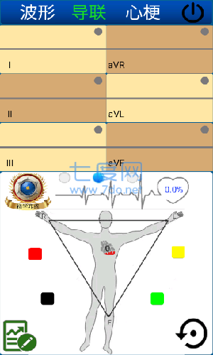 心电图ECG截图2