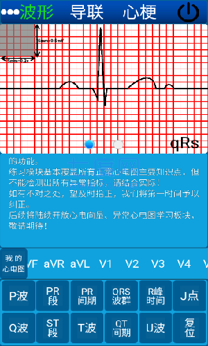 心电图ECG截图1