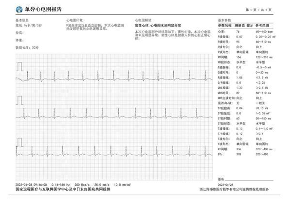 华为watchgt3pro有ECG功能吗