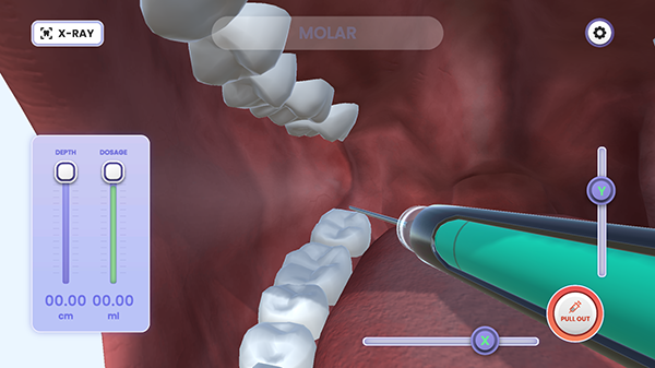 牙医模拟器截图5