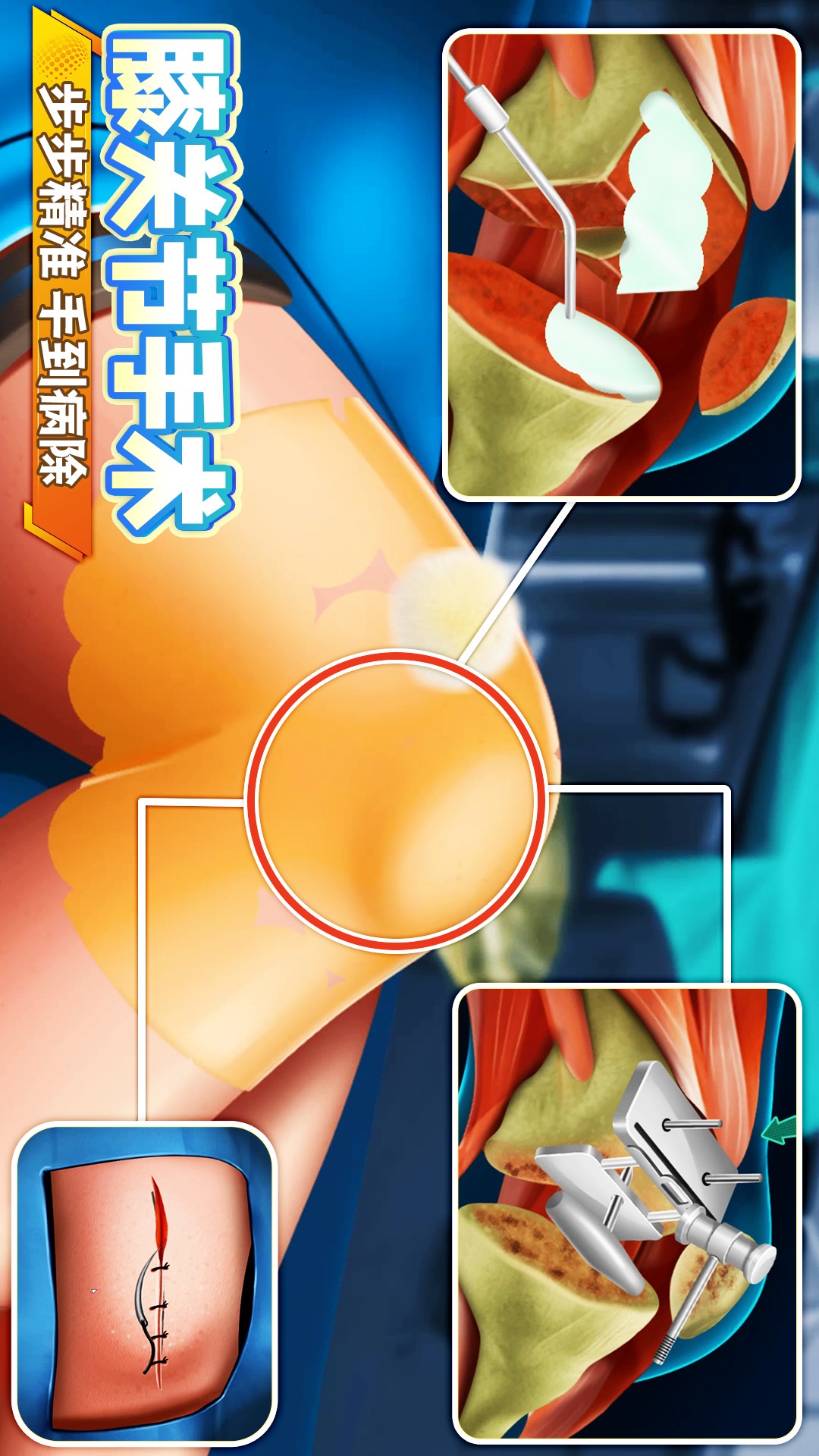 手术医生模拟游戏图3