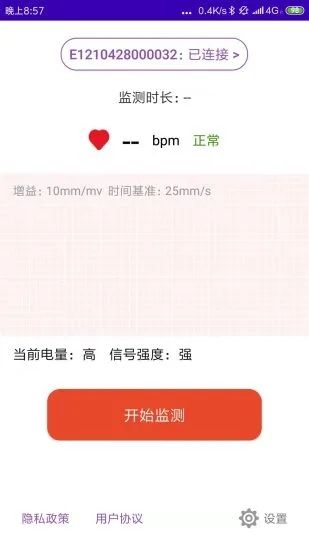 心电监测图1