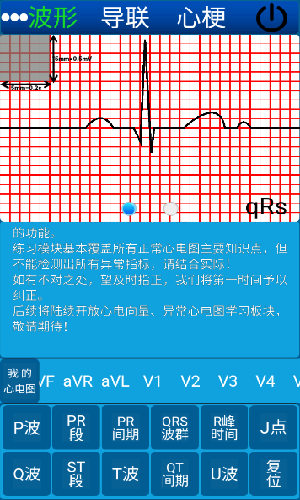 心电图ECG