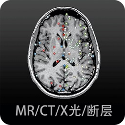 影像解剖图谱app