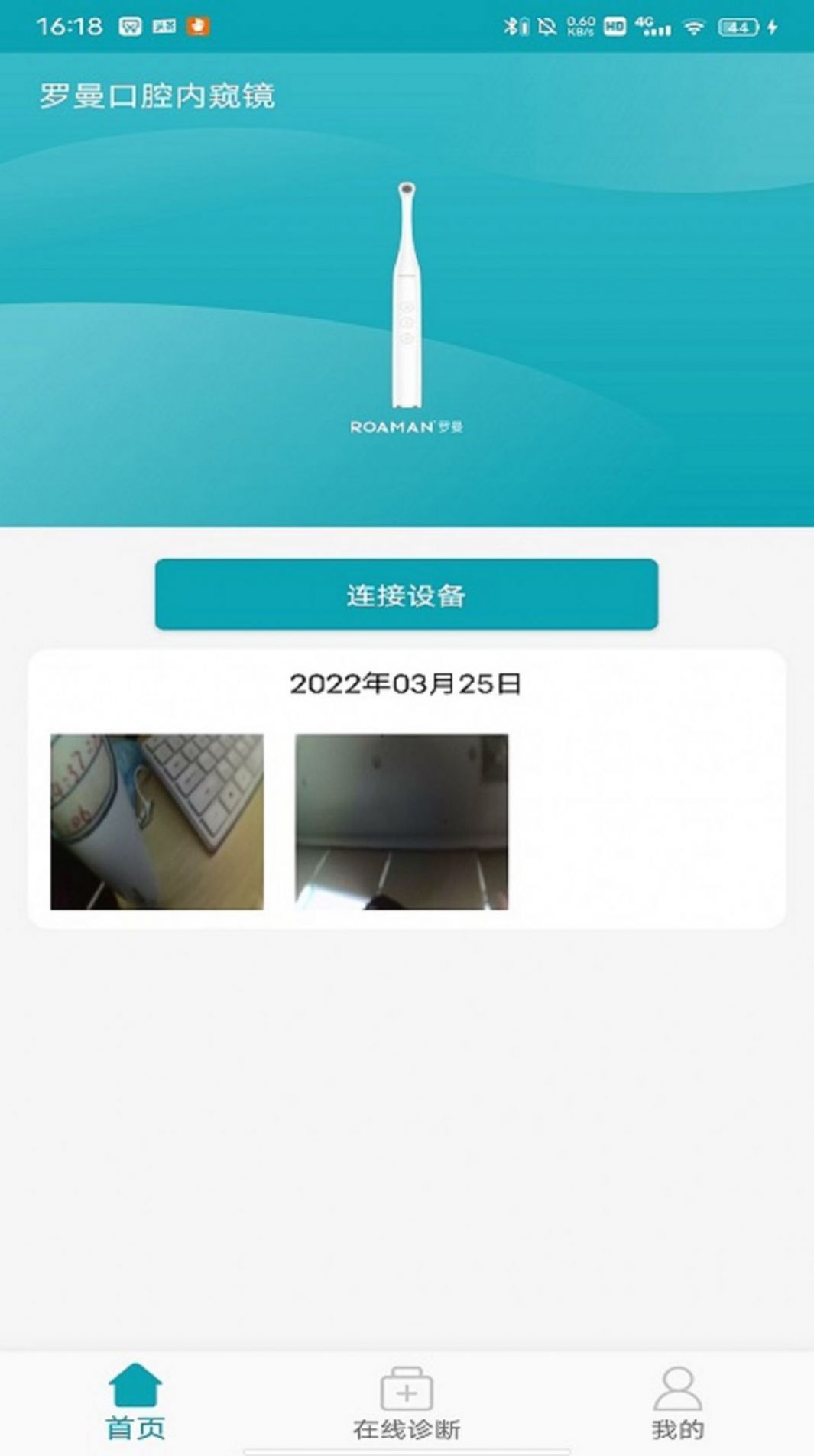 图1