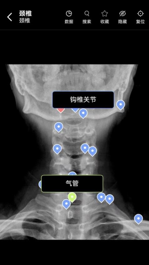 轻盈医学app-0