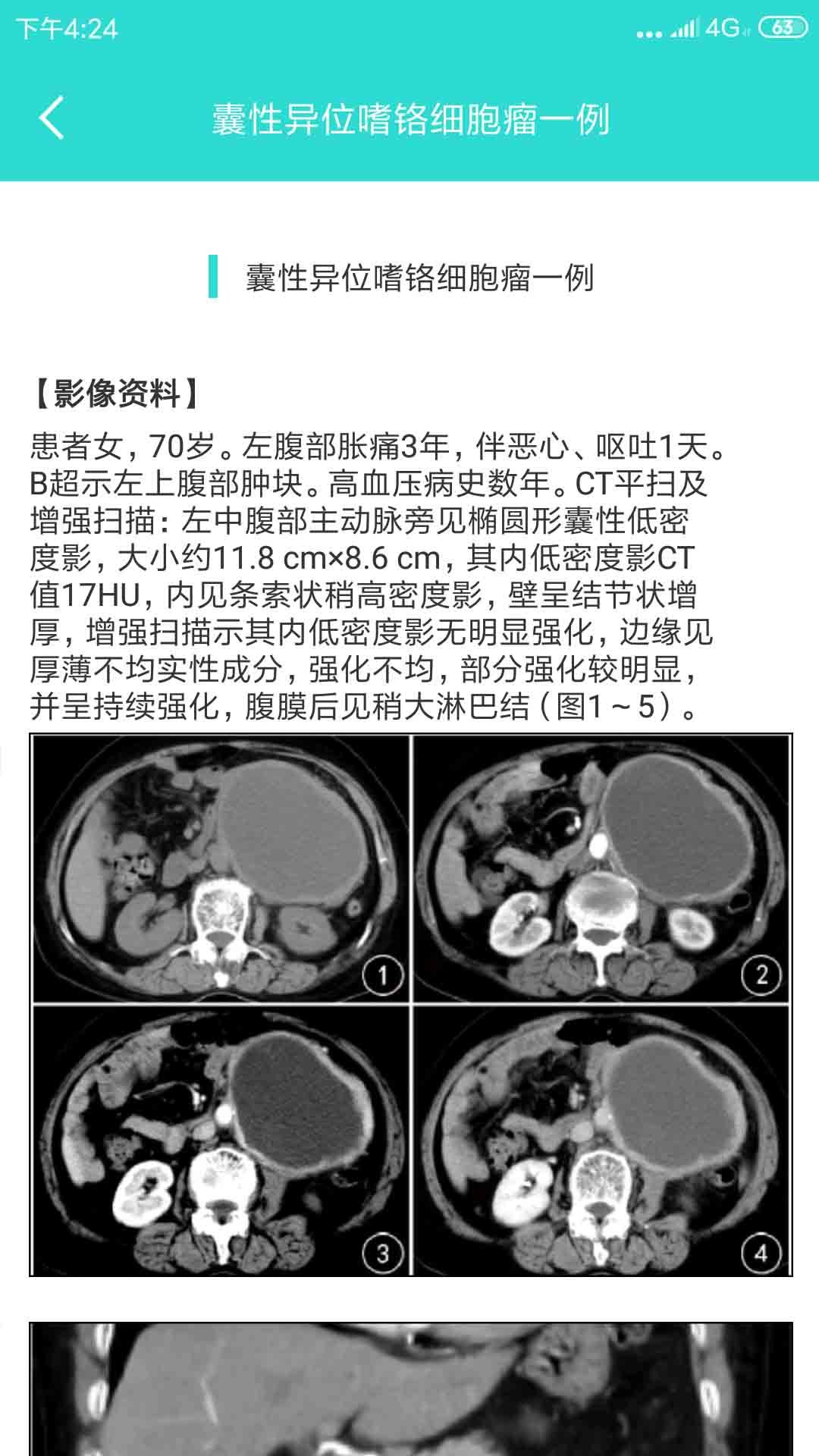 影像图鉴最新版图4