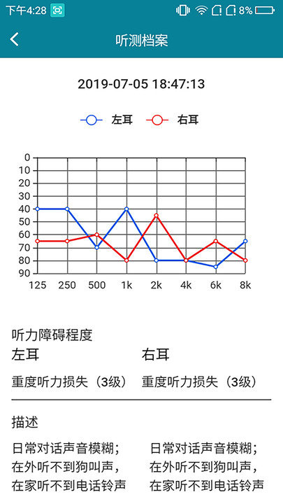 亿耳助听图1