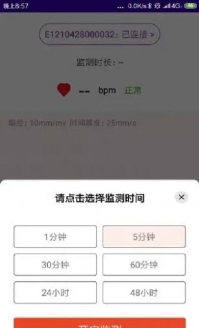 心电监测