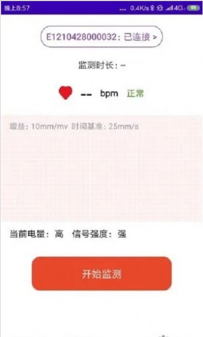心电监测