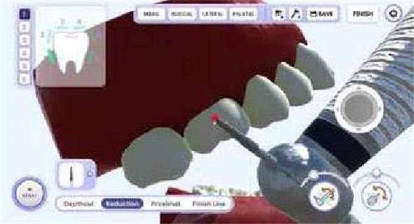 牙医模拟图1