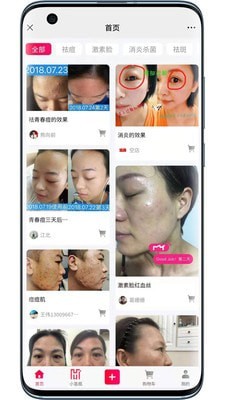 小氢瓶图3
