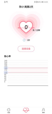fetalheart胎心仪软件图2