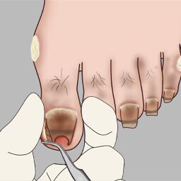 修脚大师模拟器游戏图标