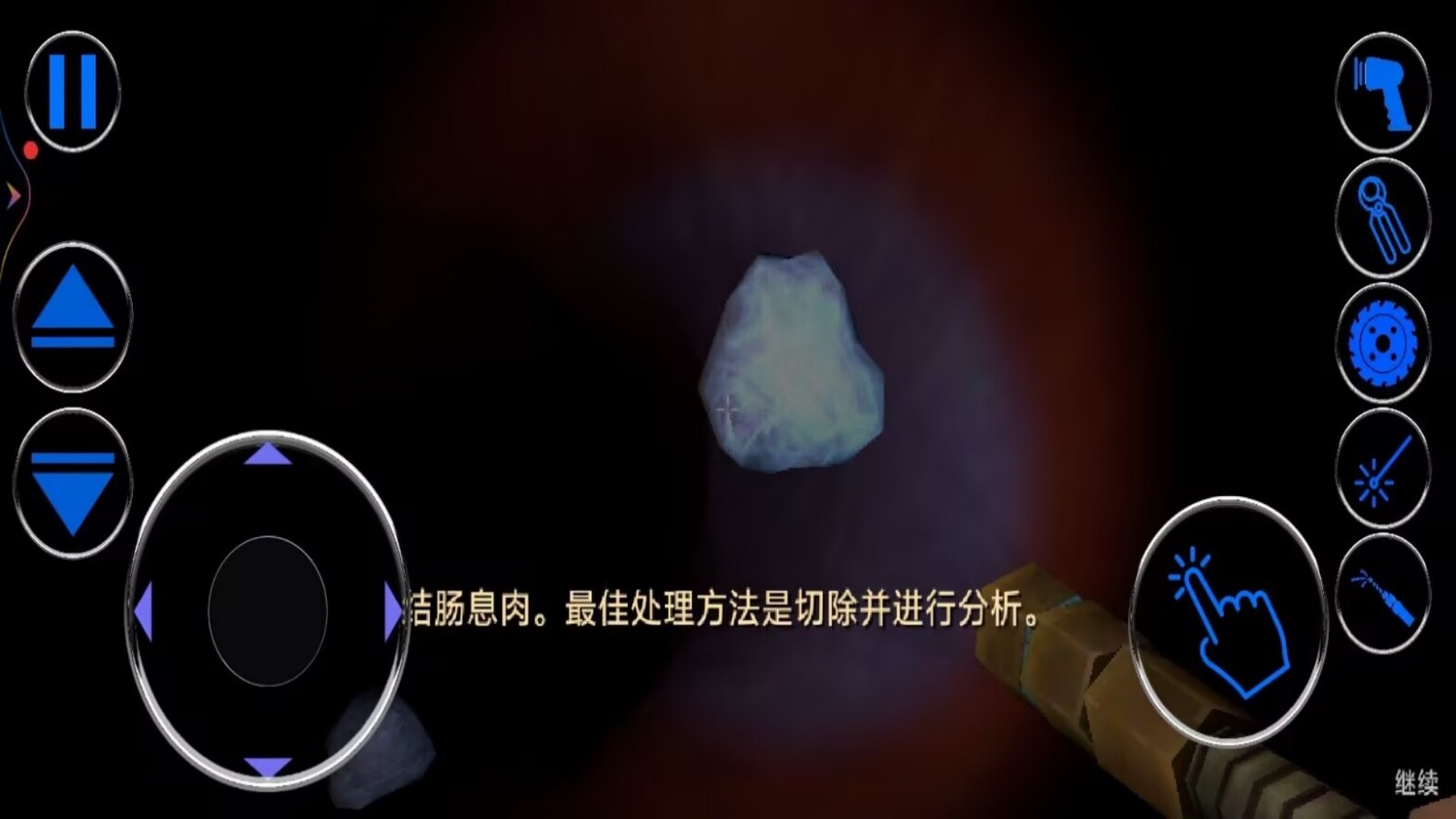 肠胃医院游戏图3
