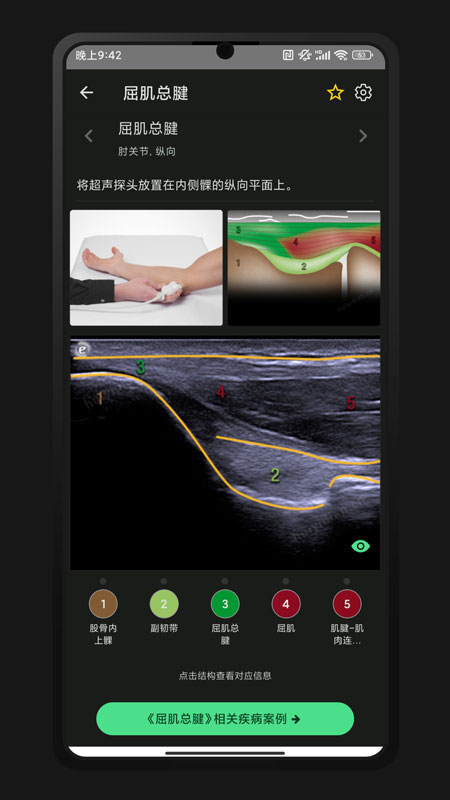 超声智学手机版图1