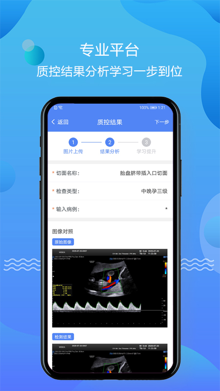 超声智库官网版
