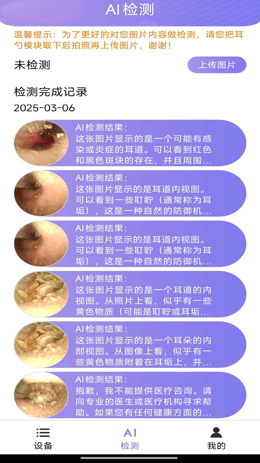 AI耳勺app图3