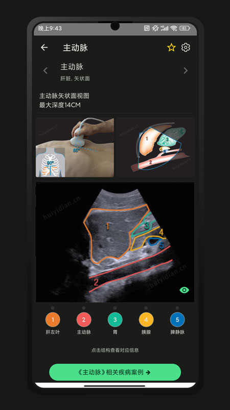 超声智学手机版图4