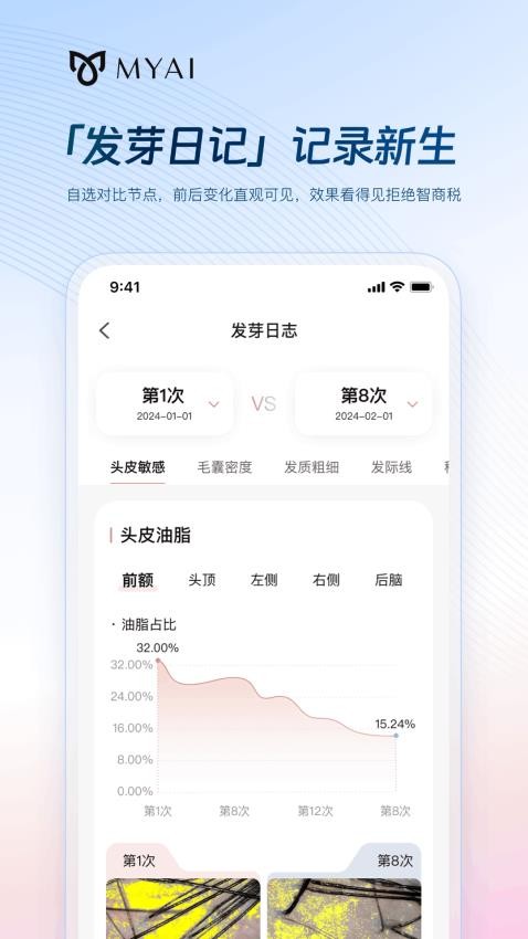 MYAI护发日记app