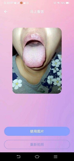 AI看舌app
