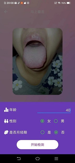 AI看舌app图2