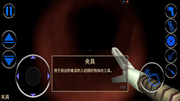 大肠的复仇1游戏图1