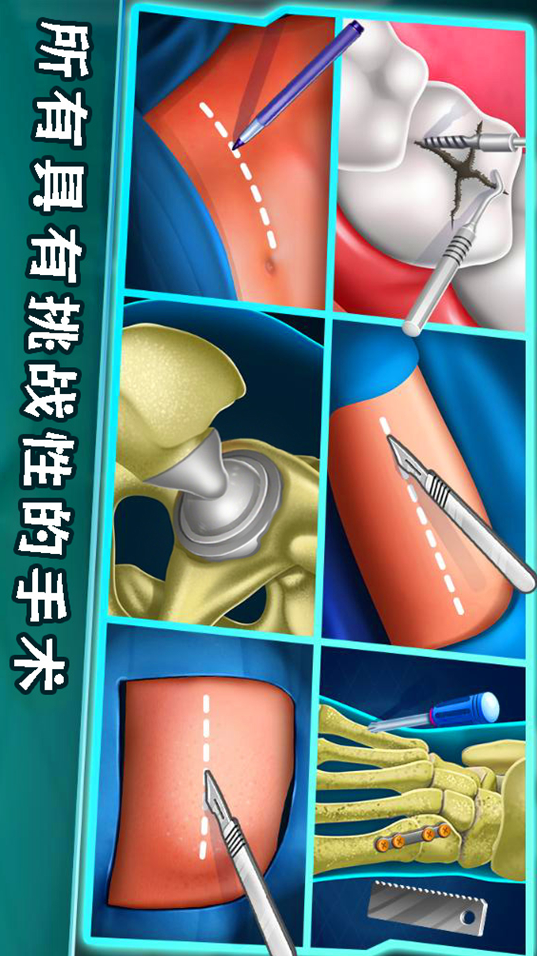 外科手术模拟器游戏图2
