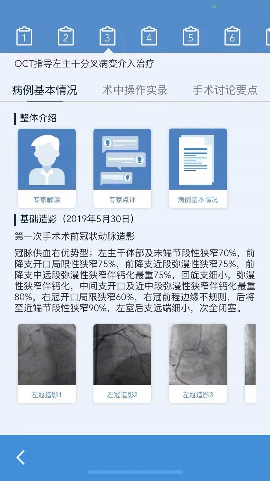 AR PCI官网版图1