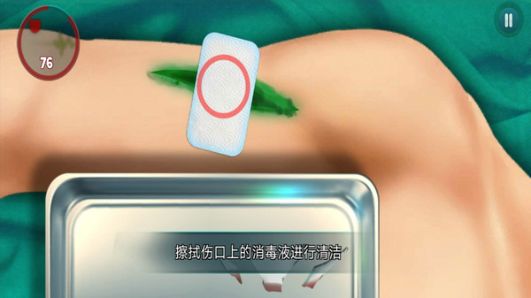 外科医生挑战游戏图1