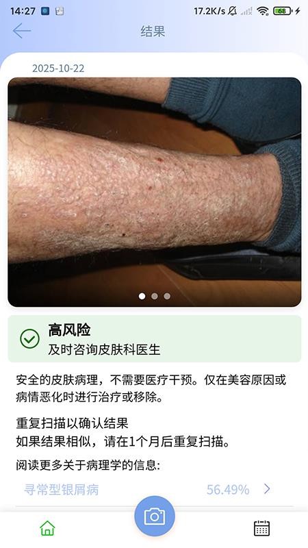 医用皮肤镜影像处理软件图3