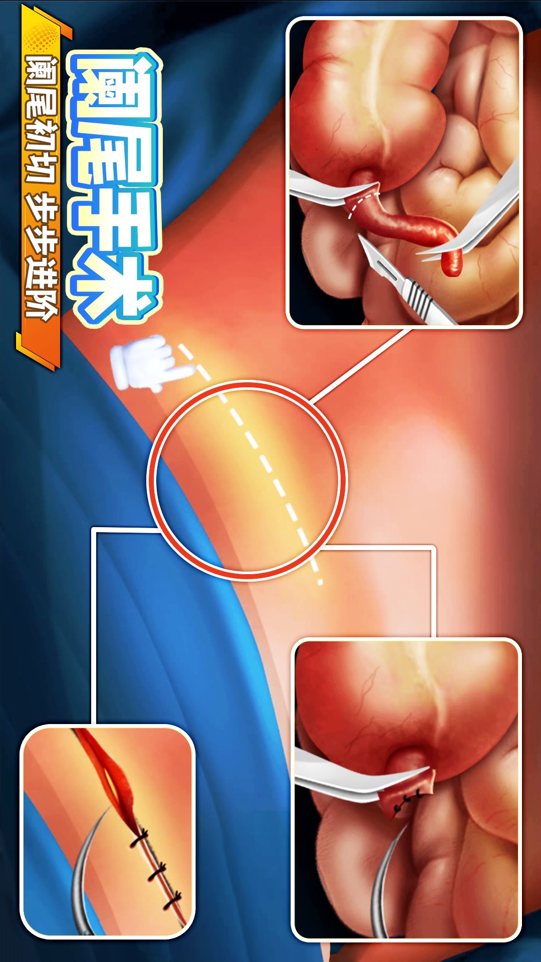 手术医生模拟游戏